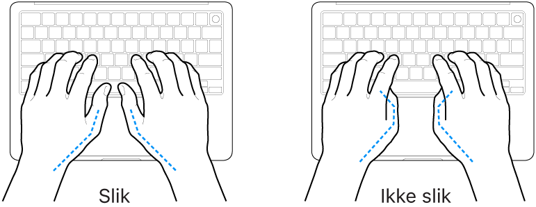 Hender plassert over et tastatur som viser riktig og feil tommelstilling.
