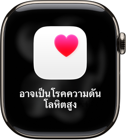 การแจ้งเตือนอัตราการเต้นของหัวใจซึ่งระบุว่าอาจเป็นโรคความดันโลหิตสูง