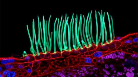 A moment from the video which won the contest. It is a cilia - which looks like lots of long green cells waving around while attached to a red surface. It's almost like seaweed floating on the ocean surface.