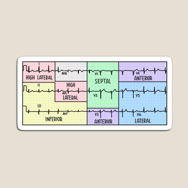 Artikelvorschau, Handgezeichnetes 12-Kanal-Elektrokardiogramm (EKG) in Pastell entworfen und verkauft von SofiaSava01.
