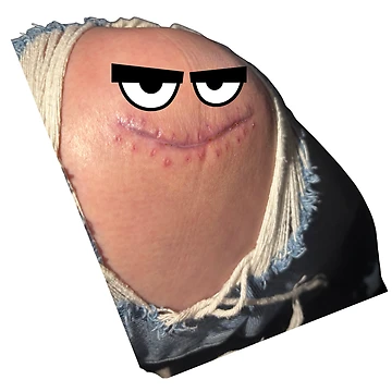 Artwork thumbnail, Franken-Knee by Royal Titan Designs