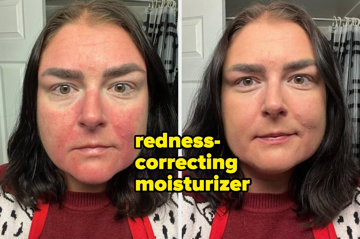 Before-and-after images of a woman using redness-correcting moisturizer; skin appears smoother and less red after application