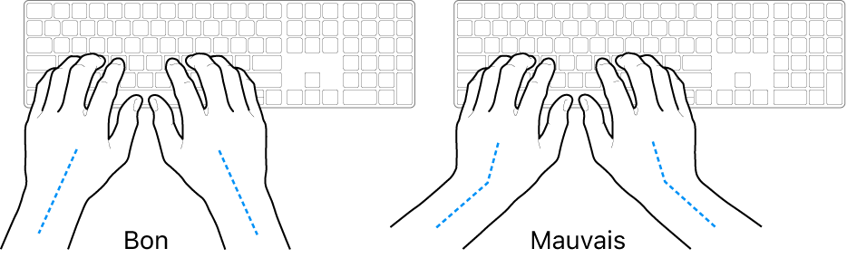 Mains placées sur un clavier, montrant le bon et le mauvais alignements des poignets et des mains.