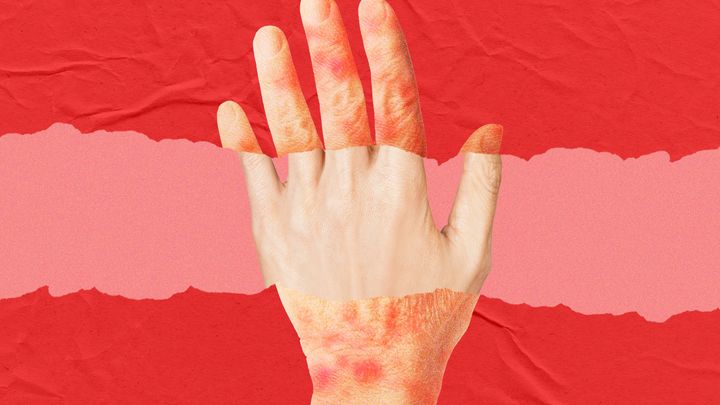 A New Anti-Aging Drug Looks to Turn Back the Clock on Skin Age