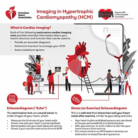 Imaging_in_HCM_Picture
